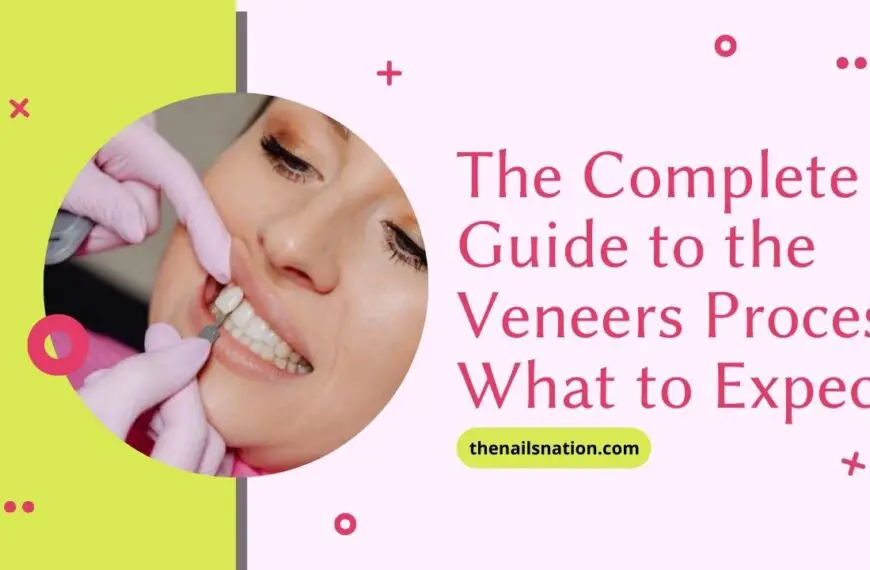 The Complete Guide to the Veneers Process: What to Expect